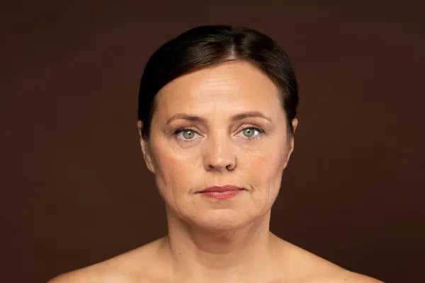 What Vitamin Deficiency Causes Sagging Skin? - Healthy Skin Lab