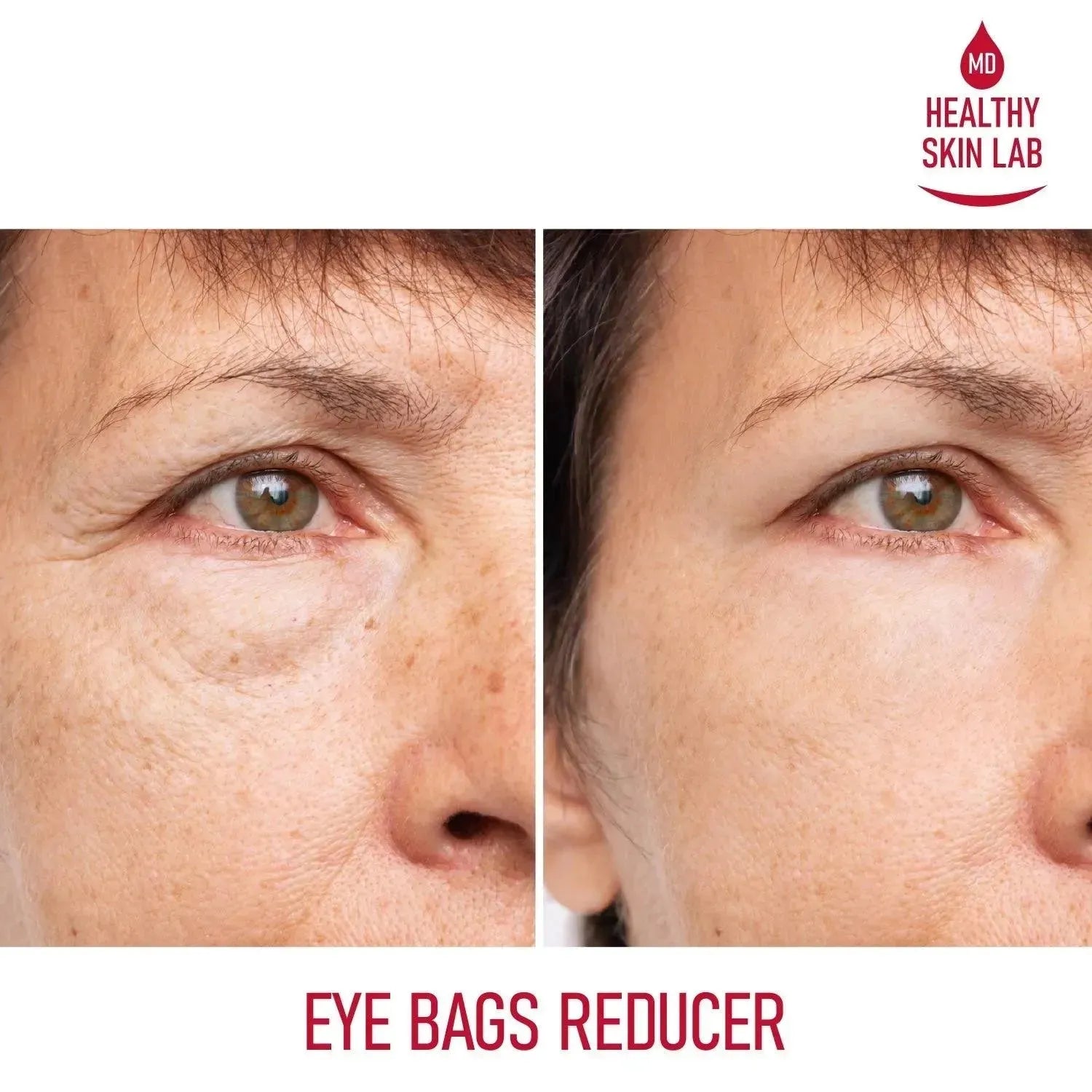 reusable-silicone-under-eye-patches-healthy-skin-lab-2 - Healthy Skin Lab